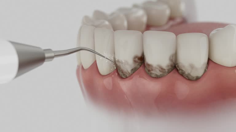 Reliable Dental contractor in Merced, CA by Smile Center Dentistry
